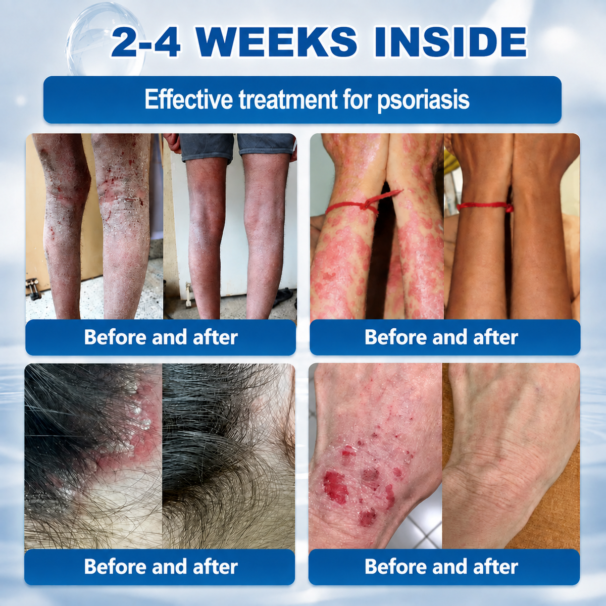 𝐇𝐞𝐚𝐥𝒓𝒊𝒛𝒆® 💃💃7-𝐃𝐚𝐲 𝐒𝐤𝐢𝐧 𝐓𝐚𝐠 & 𝐒𝐩𝐨𝐭 𝐄𝐫𝐚𝐬𝐞𝐫 𝐂𝐫𝐞𝐚𝐦 (Zero Pain, Zero 𝐒𝐜𝐚𝐫𝐬 Formula)