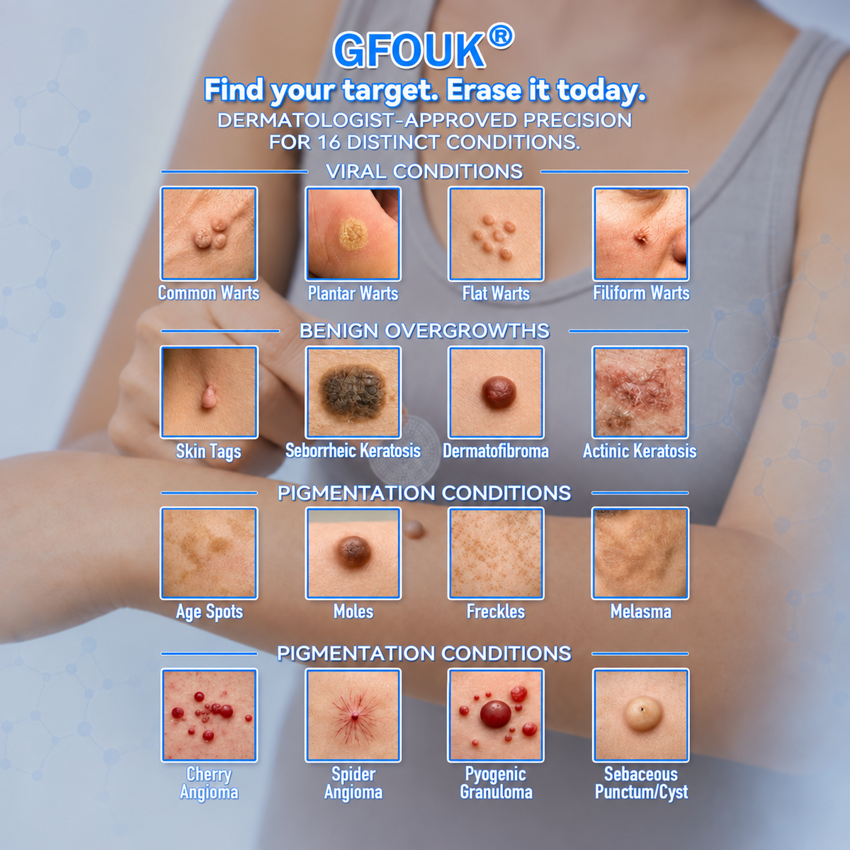 🍓 PEARLMOON®  𝐁𝐨𝐭𝐚𝐧𝐢𝐜𝐚𝐥 𝐌𝐢𝐜𝐫𝐨𝐧𝐞𝐞𝐝𝐥𝐞 𝐇𝐲𝐝𝐫𝐨𝐜𝐨𝐥𝐥𝐨𝐢𝐝 𝐏𝐚𝐭𝐜𝐡 (𝐅𝐨𝐫 𝐒𝐤𝐢𝐧 𝐓𝐚𝐠𝐬, 𝐖𝐚𝐫𝐭𝐬, 𝐌𝐨𝐥𝐞𝐬, 𝐀𝐠𝐞 𝐒𝐩𝐨𝐭𝐬 & 𝐏𝐢𝐠𝐦𝐞𝐧𝐭𝐚𝐭𝐢𝐨𝐧 𝐂𝐨𝐧𝐜𝐞𝐫𝐧𝐬)