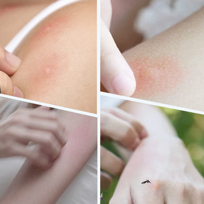 2026 Upgraded Ultrasonic Mosquito Repellent Bracelet
